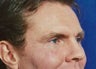Facial Fat Grafting