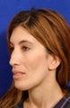 Fascial Fat Grafting