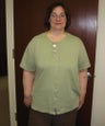 Laparoscopic Gastric Bypass