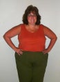 Weight Loss Surgery