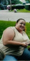 Gastric Bypass