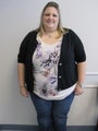 Roux en-Y Gastric Bypass