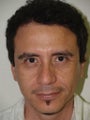 Hair Transplant and Eyebrow Transplant