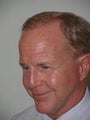 Extended Midfacelift and Hair Transplant
