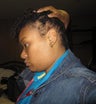 Hair Transplant