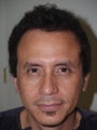 Hair Transplant and Eyebrow Transplant