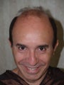Hair Transplant