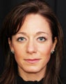 Facial balancing and reversal of early aging changes with Juvederm Ultra Plus XC