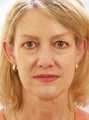 Woman wanting more youthful appearance