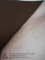 Laser Hair Removal to Bikini Area