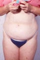 Liposuction