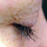 Dr. Lorrie Klein's eyelashes before and after Latisse