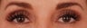 Eyelash Growth from Latisse