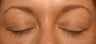 LATISSE
