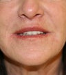 Lips