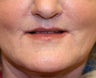 Lips
