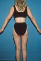 Total Body Liposculpture
