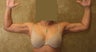 liposuction of arms for women