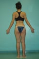 Liposculpture of inner and outer thighs