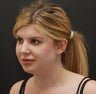 Neck Lipocontouring