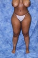 Liposuction and Fat Injection