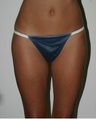 Liposuction