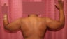 liposuction of arms for women