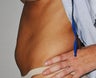 Mini-abdominoplasty