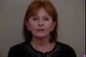 58 year old female seeking surgery for facial and neck rejuvenation, laxity of skin, peri-oral smokers lines