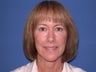 Before and After Nonsurgical Facelift