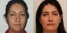 Liquid Face lift