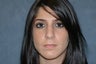 Rhinoplasty