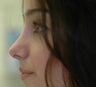 Rhinoplasty