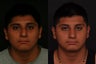 Rhinoplasty