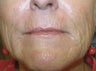 Getting great results with Pearl Fractional