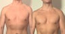 Pectoral implants