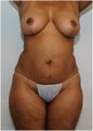 Body Makeover