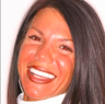 Porcelain veneers