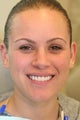 veneer and crown correction