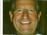 Veneers