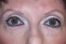 Prevelle Silk Under the Eyes