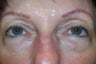 Prevelle Silk Under the Eyes