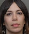 Eye Dermafillers,Cheek Dermafillers.Facial Dermafillers,Nasolabial Dermafillers