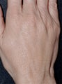 Aging Hands