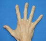 Filler in Hands