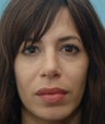 Eye Dermafillers,Cheek Dermafillers.Facial Dermafillers,Nasolabial Dermafillers