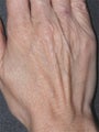 Aging Hands