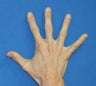 Filler in Hands