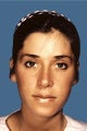 Rhinoplasty
