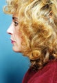 Revision Rhinoplasty